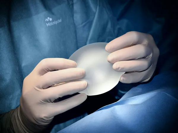 Breast Implant